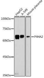 P4HA2 Antibody in Western Blot (WB)