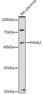 P4HA2 Antibody in Western Blot (WB)