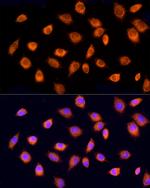 RPH3AL Antibody in Immunocytochemistry (ICC/IF)