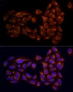 RPH3AL Antibody in Immunocytochemistry (ICC/IF)