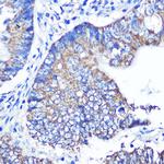 ABCG1 Antibody in Immunohistochemistry (Paraffin) (IHC (P))