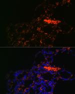 ABCG1 Antibody in Immunohistochemistry (Paraffin) (IHC (P))