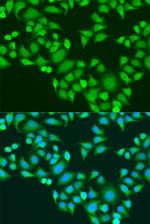 IGF2BP3 Antibody in Immunocytochemistry (ICC/IF)