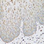 IGF2BP3 Antibody in Immunohistochemistry (Paraffin) (IHC (P))