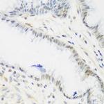 IGF2BP3 Antibody in Immunohistochemistry (Paraffin) (IHC (P))