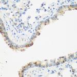 IGF2BP3 Antibody in Immunohistochemistry (Paraffin) (IHC (P))