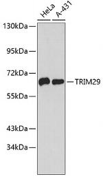 TRIM29 Antibody in Western Blot (WB)