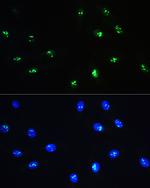 NOP58 Antibody in Immunocytochemistry (ICC/IF)