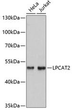 LPCAT2 Antibody in Western Blot (WB)