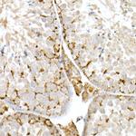 NPC2 Antibody in Immunohistochemistry (Paraffin) (IHC (P))