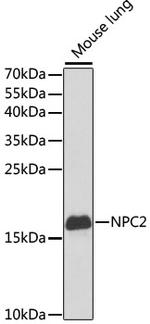 NPC2 Antibody in Western Blot (WB)