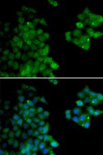 PSMB10 Antibody in Immunocytochemistry (ICC/IF)