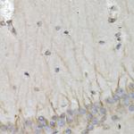 PSMB10 Antibody in Immunohistochemistry (Paraffin) (IHC (P))