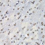 PSMB10 Antibody in Immunohistochemistry (Paraffin) (IHC (P))