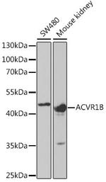 ACVR1B Antibody in Western Blot (WB)