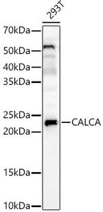 APRT Antibody in Western Blot (WB)