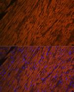 MYL2 Antibody in Immunohistochemistry (Paraffin) (IHC (P))