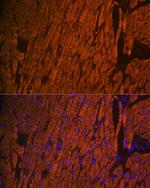 MYL2 Antibody in Immunohistochemistry (Paraffin) (IHC (P))