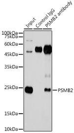 PSMB2 Antibody in Immunoprecipitation (IP)