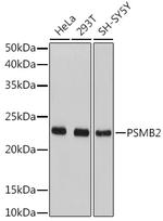 PSMB2 Antibody in Western Blot (WB)