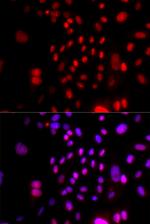 RFC4 Antibody in Immunocytochemistry (ICC/IF)