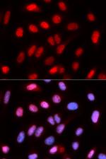 RFC4 Antibody in Immunocytochemistry (ICC/IF)