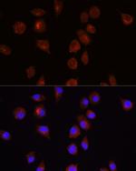 AKT1 Antibody in Immunocytochemistry (ICC/IF)