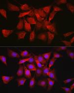 AKT1 Antibody in Immunocytochemistry (ICC/IF)