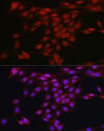 AKT1 Antibody in Immunocytochemistry (ICC/IF)