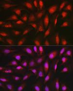 AKT1 Antibody in Immunocytochemistry (ICC/IF)