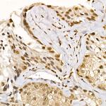 AKT1 Antibody in Immunohistochemistry (Paraffin) (IHC (P))