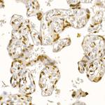 AKT1 Antibody in Immunohistochemistry (Paraffin) (IHC (P))