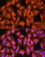 GNAS Antibody in Immunocytochemistry (ICC/IF)