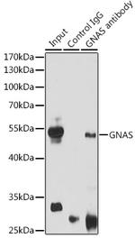 GNAS Antibody in Immunoprecipitation (IP)