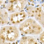 RNF2 Antibody in Immunohistochemistry (Paraffin) (IHC (P))