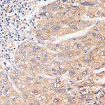 WNK3 Antibody in Immunohistochemistry (Paraffin) (IHC (P))