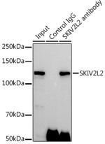 SKIV2L2 Antibody in Immunoprecipitation (IP)