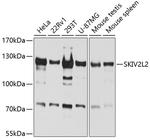 SKIV2L2 Antibody in Western Blot (WB)