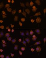 ICAM-1 Antibody in Immunocytochemistry (ICC/IF)