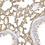 ICAM-1 Antibody in Immunohistochemistry (Paraffin) (IHC (P))