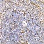 ICAM-1 Antibody in Immunohistochemistry (Paraffin) (IHC (P))