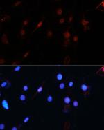 ZEB1 Antibody in Immunocytochemistry (ICC/IF)