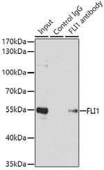 FLI1 Antibody in Immunoprecipitation (IP)