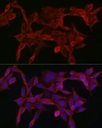 SMAD4 Antibody in Immunocytochemistry (ICC/IF)