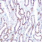 SMAD4 Antibody in Immunohistochemistry (Paraffin) (IHC (P))