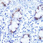 SMAD4 Antibody in Immunohistochemistry (Paraffin) (IHC (P))