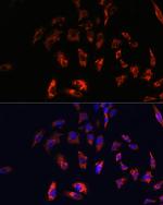 CD74 Antibody in Immunocytochemistry (ICC/IF)