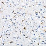 CD74 Antibody in Immunohistochemistry (Paraffin) (IHC (P))