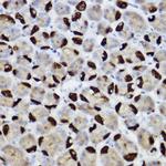 BNIP3 Antibody in Immunohistochemistry (Paraffin) (IHC (P))