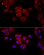 Fumarase Antibody in Immunocytochemistry (ICC/IF)